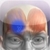 Muscle Trigger Points