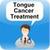 Tongue Cancer Treatment