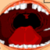 Extraction Of Teeth
